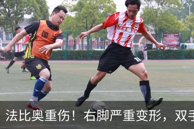 法比奥重伤！右脚严重变形，双手掩面退场，媒体人：或赛季报销